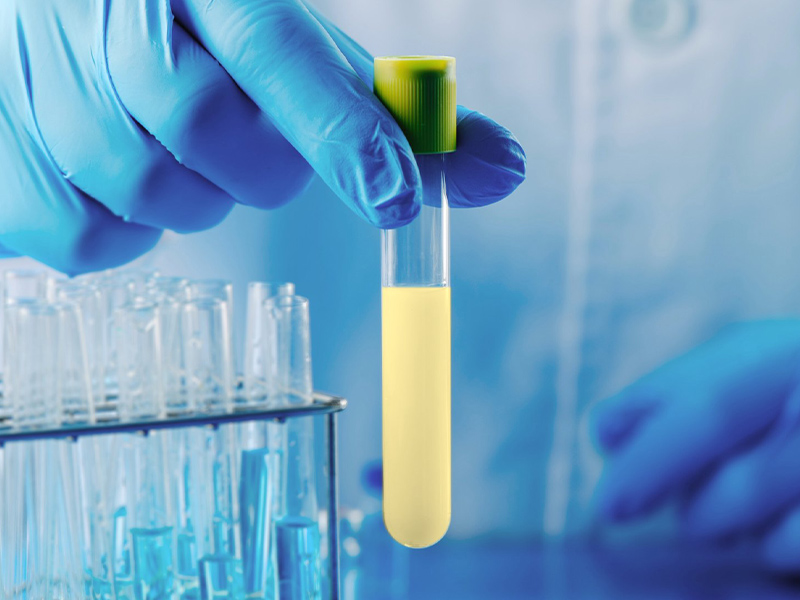 Gloved hand holding a test tube of pale yellow apigenin solution beside a sample rack, illustrating apigenin purity testing